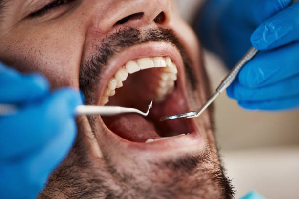 Best Root Canal Emergency Dentist  in Mustang Ridge, TX
